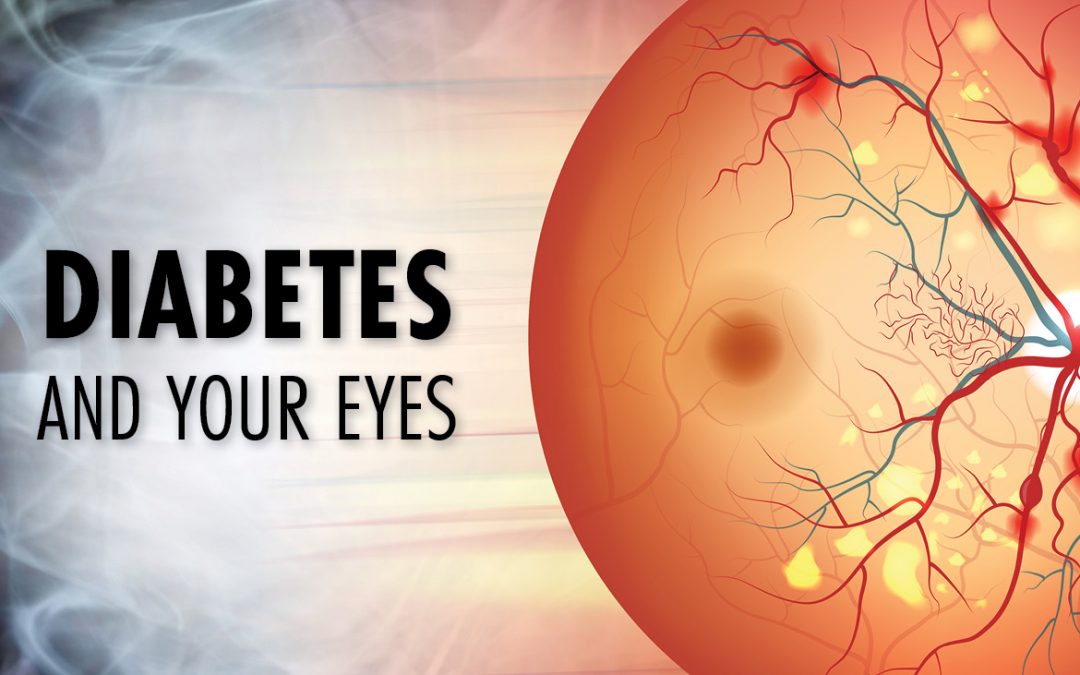 Types of Diabetic Eye Disease